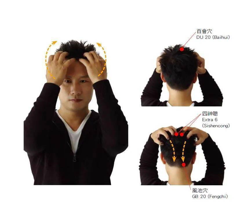 头发一抓就掉一把怎么回事,头发抓一把就掉一把