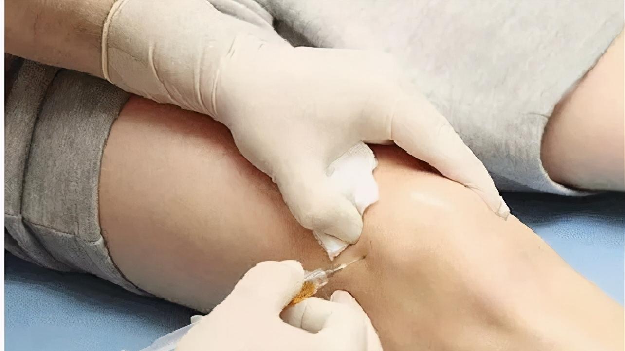 富血小板血浆因子作用,富血小板血浆治疗的目的和意义