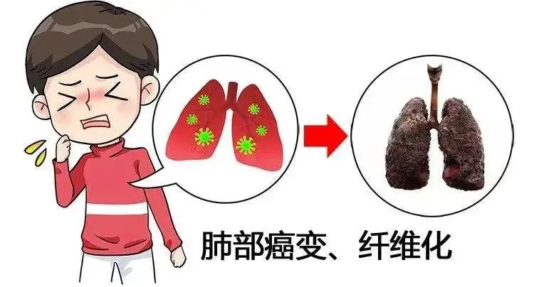 肝硬化干细胞移植改善肝功能,干细胞治疗秒懂