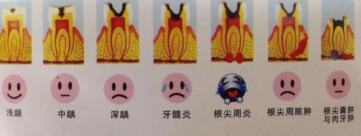 补的牙遇冷热疼怎么办,为什么补了牙反而疼了