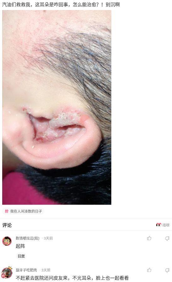 神回复:为什么近视的人睡觉不戴眼镜,那他们晚上做梦能看得清吗