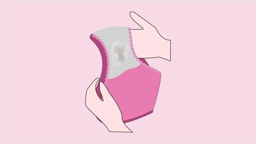 女裤穿一天就变黄还有股异味,女裤发黄是有妇科病吗