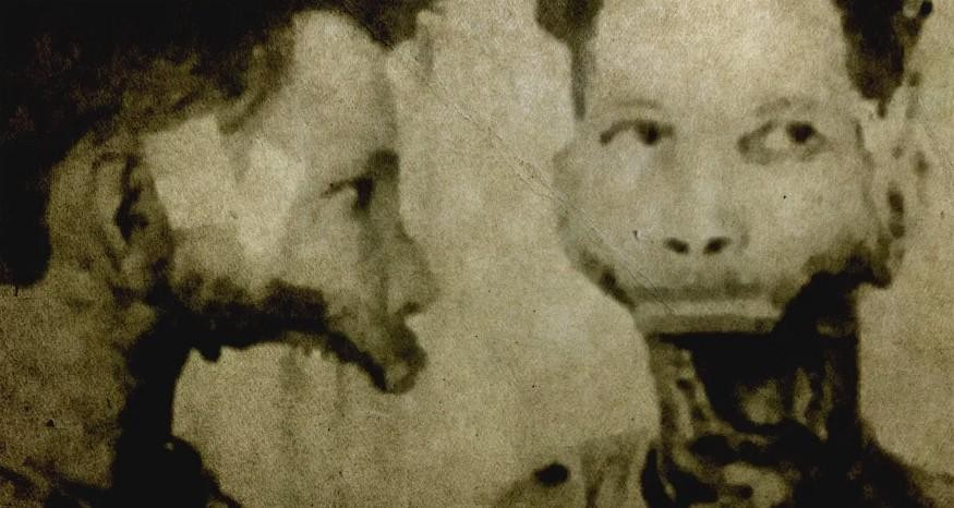 男子喝了1400瓶辐射水,男子喝核辐射水后下巴糜烂