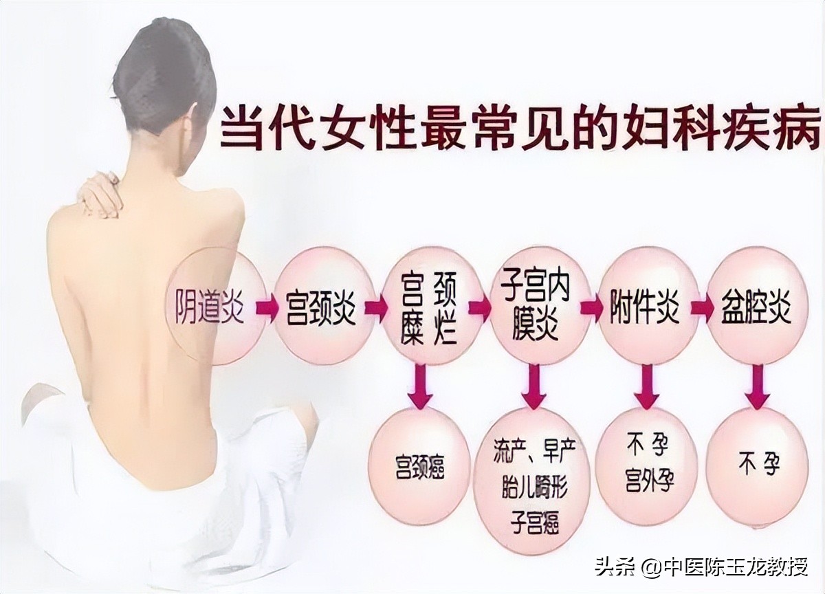 八正散加桂枝茯苓丸治疗前列腺炎,八正丸能治湿热瘀阻型前列腺炎