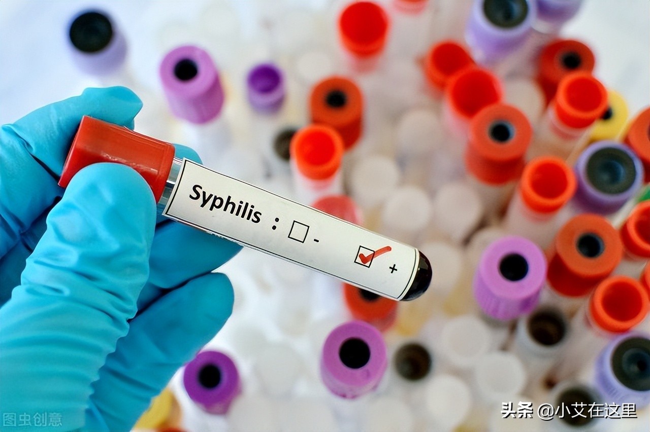 高危行为后，各类性病需要多久能检测出来？