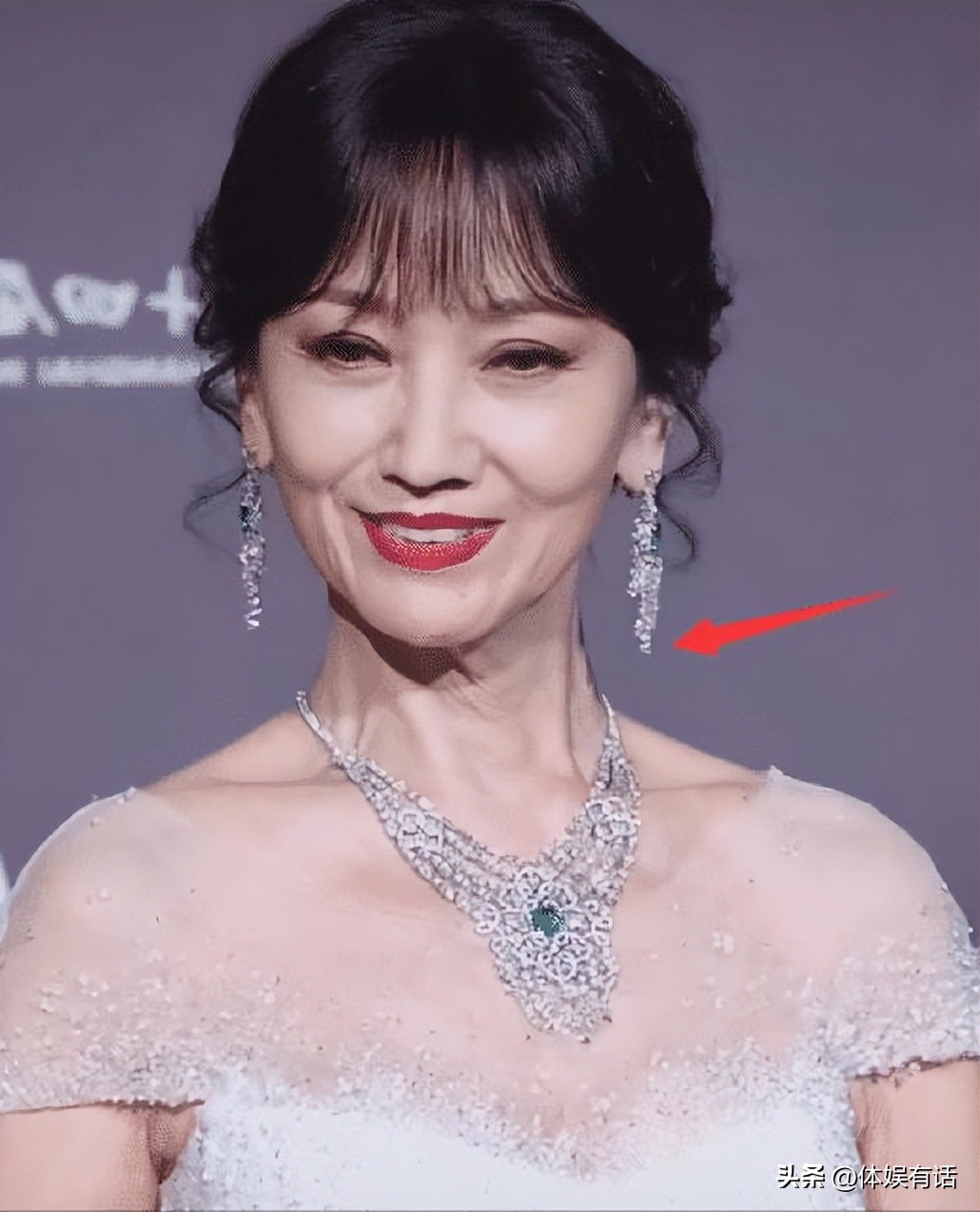 面部衰老皱纹图,面部衰老皱纹解剖图