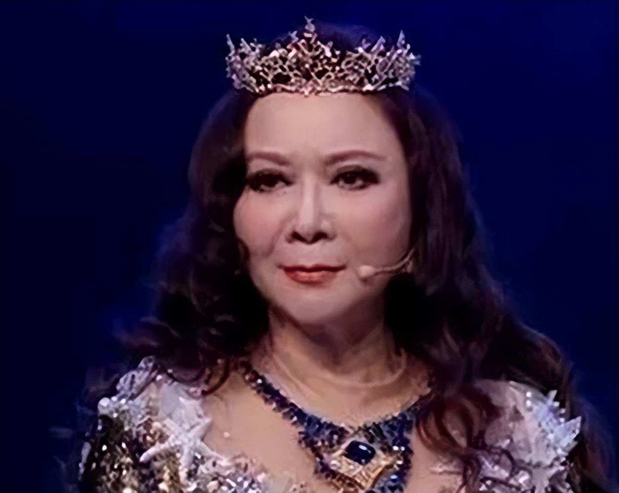 最失败硅胶脸的女星,硅胶脸女明星排行