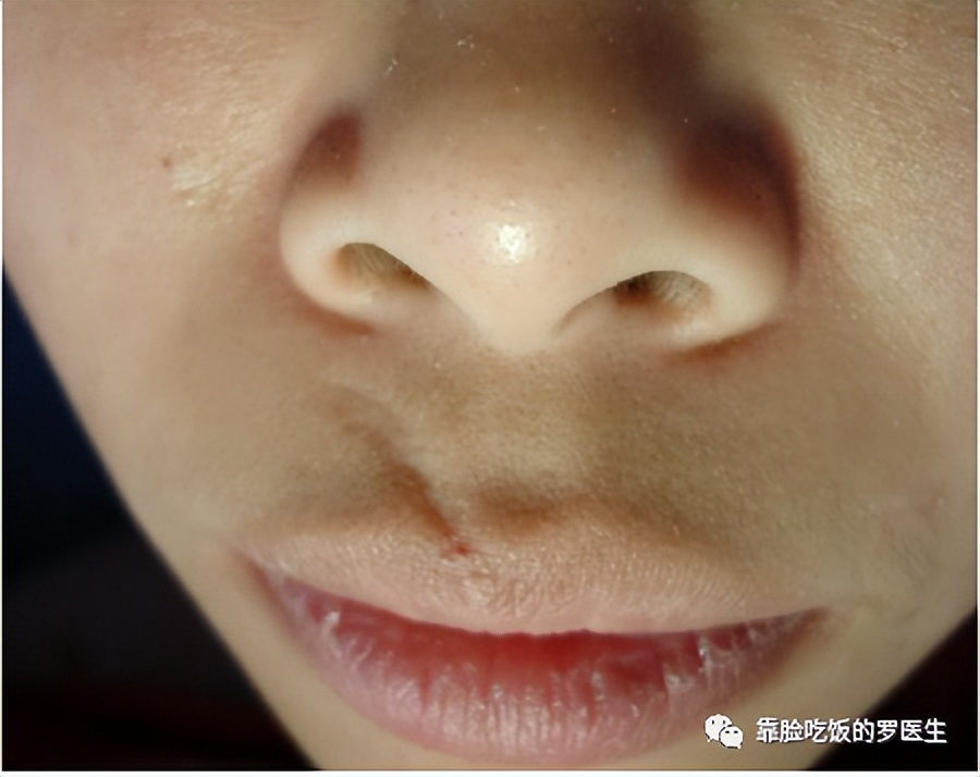 科普疤痕知多少,瘢痕科普视频