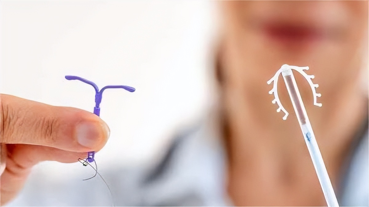 节育环在女性体内，会发生哪些变化？30年前上环的女性有哪些结局