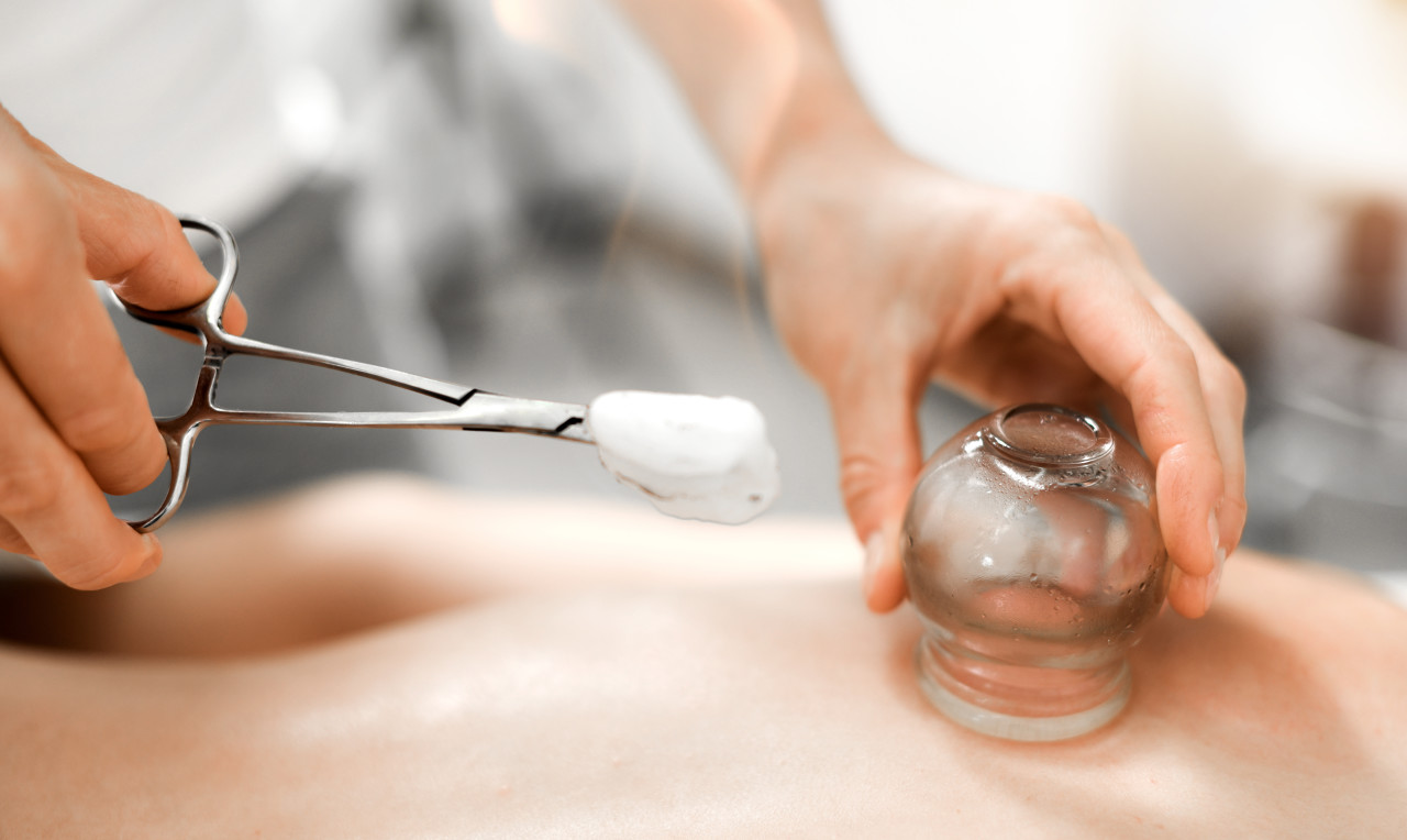 运动员拔罐注意事项和禁忌,为什么拔罐会有那么多好处