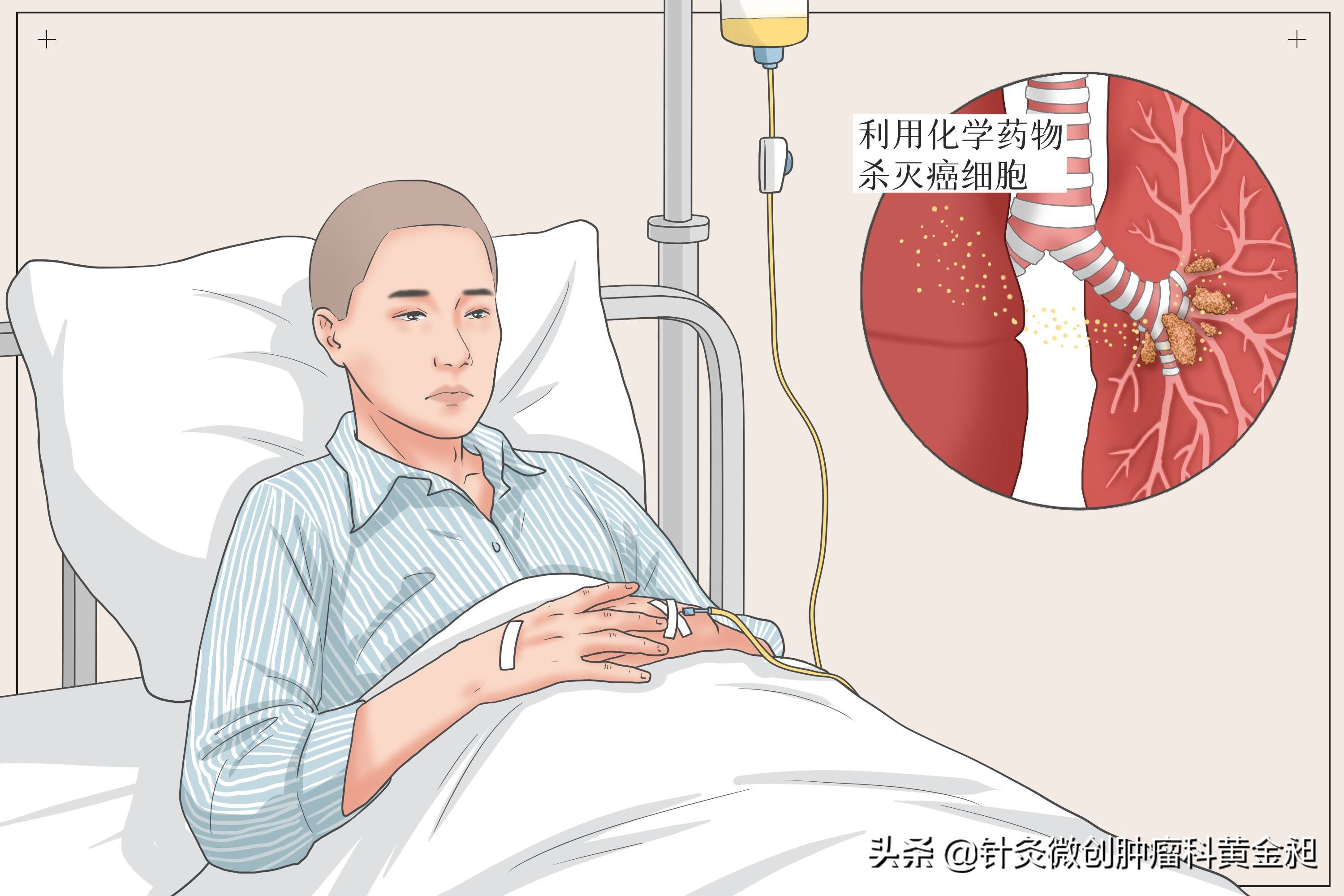 化疗腹泻吃什么药,化疗后腹泻怎么办什么方法最有效