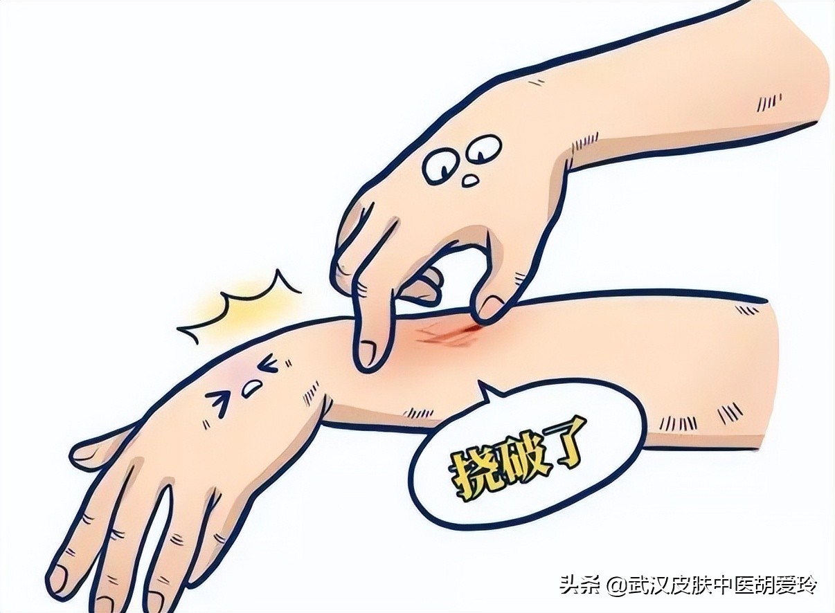 春季身上痒一挠就有疙瘩怎么治疗,老人家身痒用什么治疗