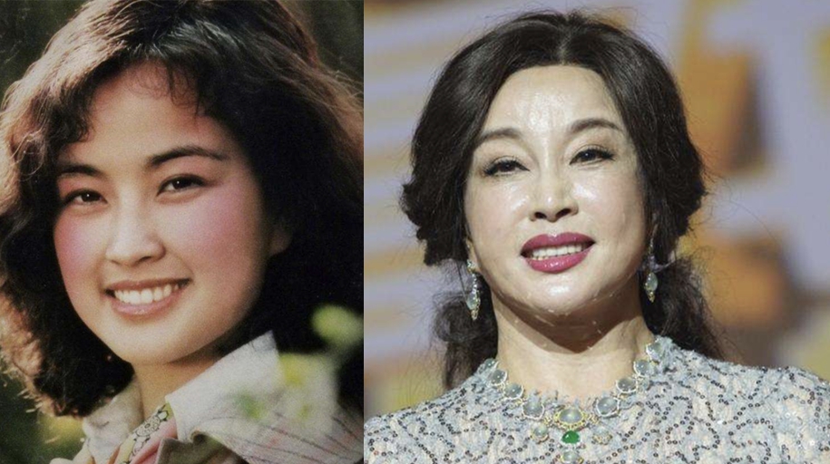 老演员整容脸变形,老年人整容前后照片