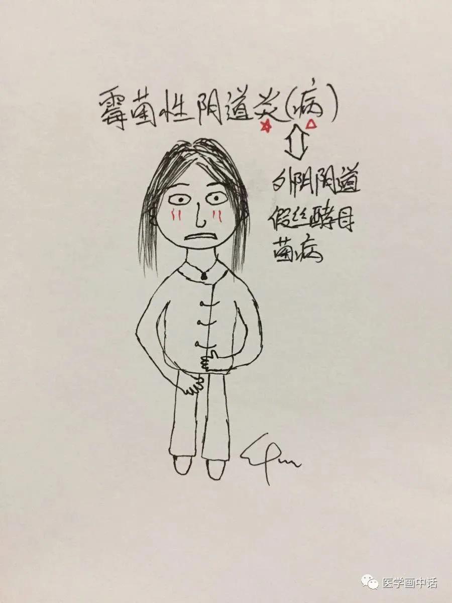 霉菌外阴炎瘙痒用什么药效果好,外阴瘙痒是霉菌炎用什么药最好