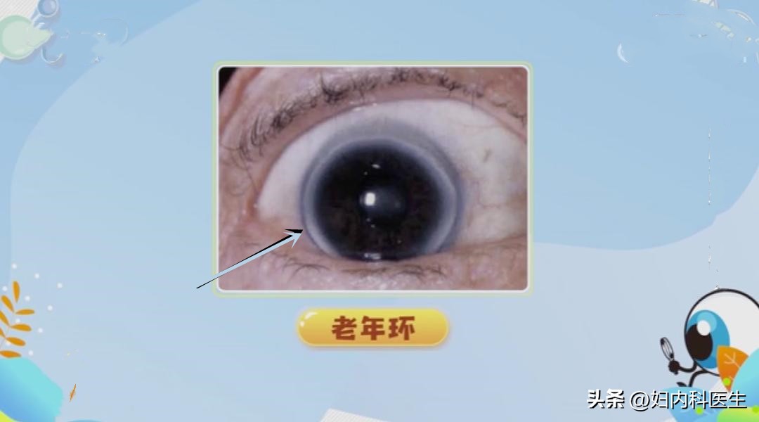 从脸色看出得什么病,面色反映一个人的健康