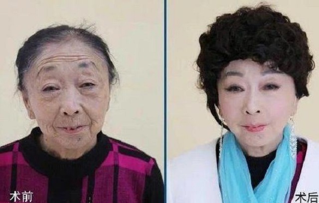 26岁小伙娶58岁阿姨18年后离婚,28岁小伙娶了42岁大姐