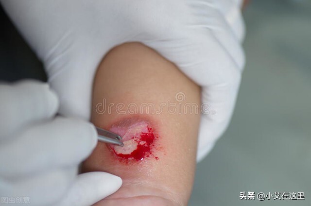 hiv感染风险评估,hiv感染高危因素