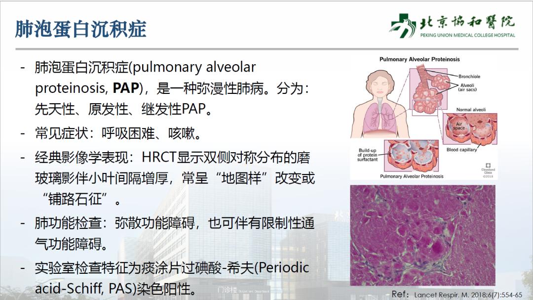 ecmo体外人工膜肺ppt,vv-ecmo怎么用