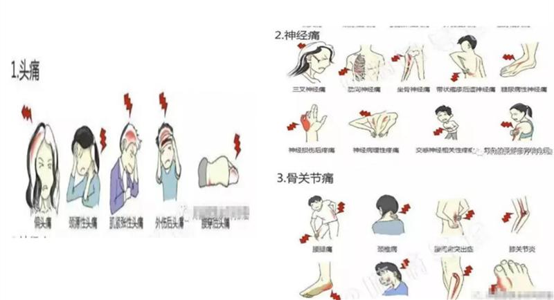 嘉善人民医院疼痛科专家,嘉善第一人民医院中医内科