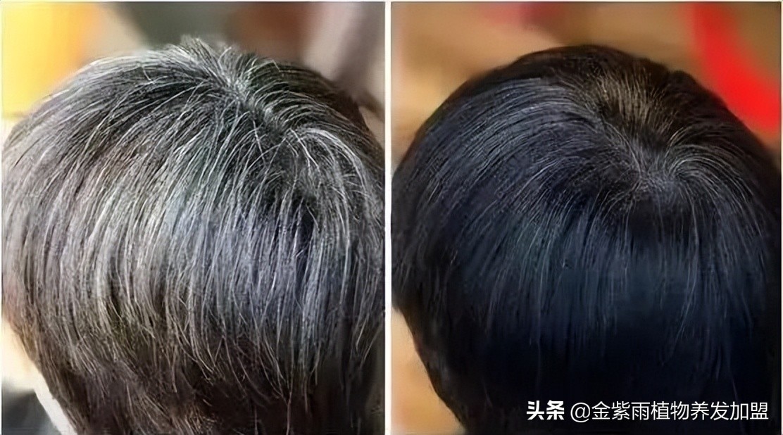 养发馆排行榜10强白转黑加盟,白转黑加盟店哪种产品效果好