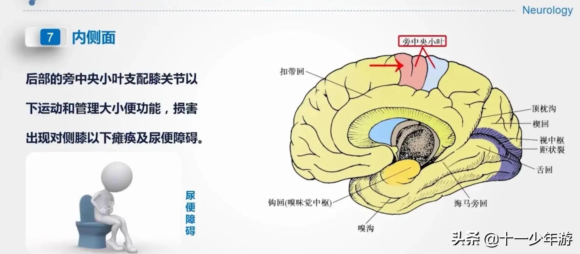 大脑的结构解剖示意图,大脑镰下疝解剖结构