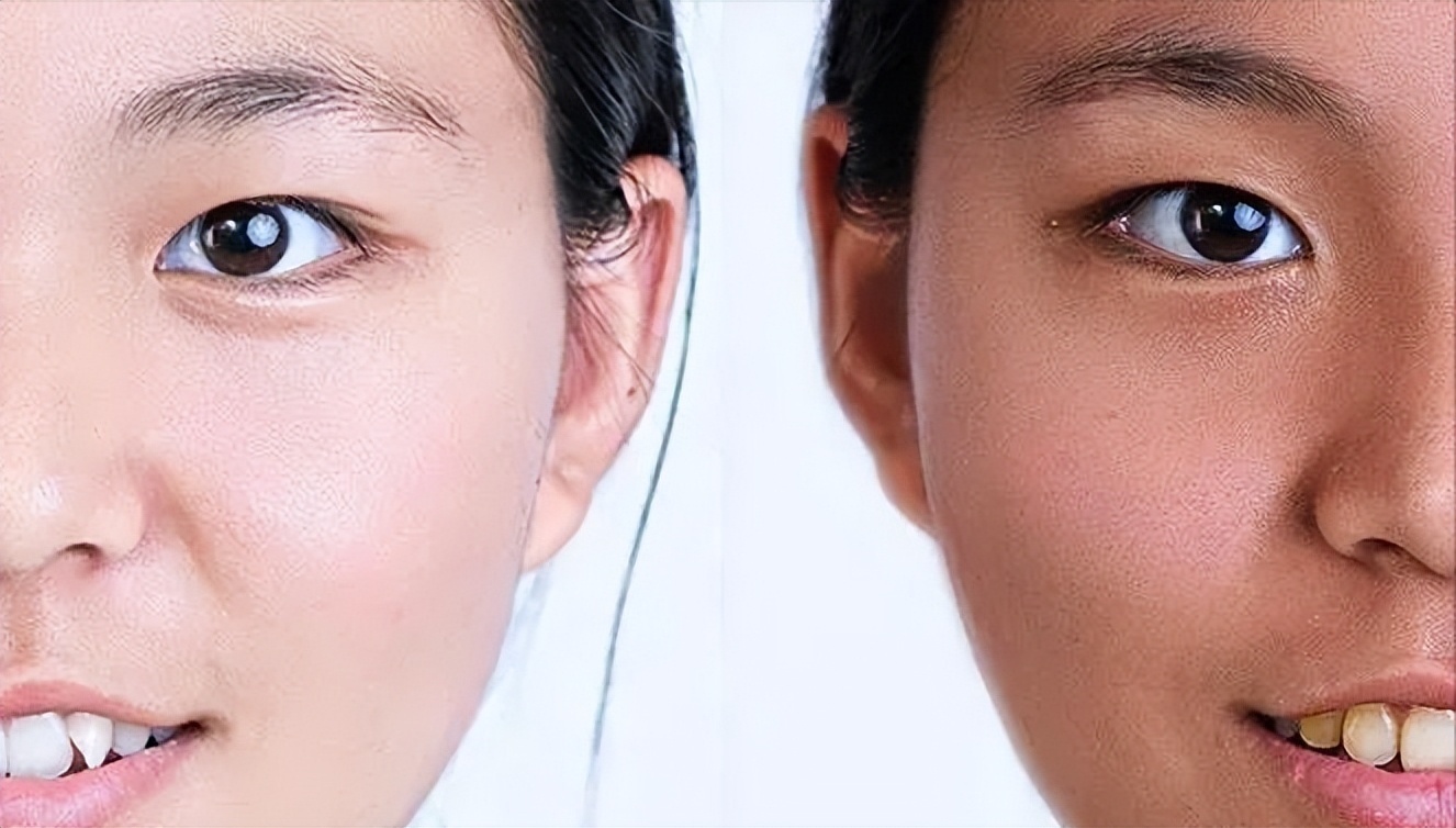 ps磨皮插件dr5能处理疤痕吗,dr5磨皮插件哪个版本最好