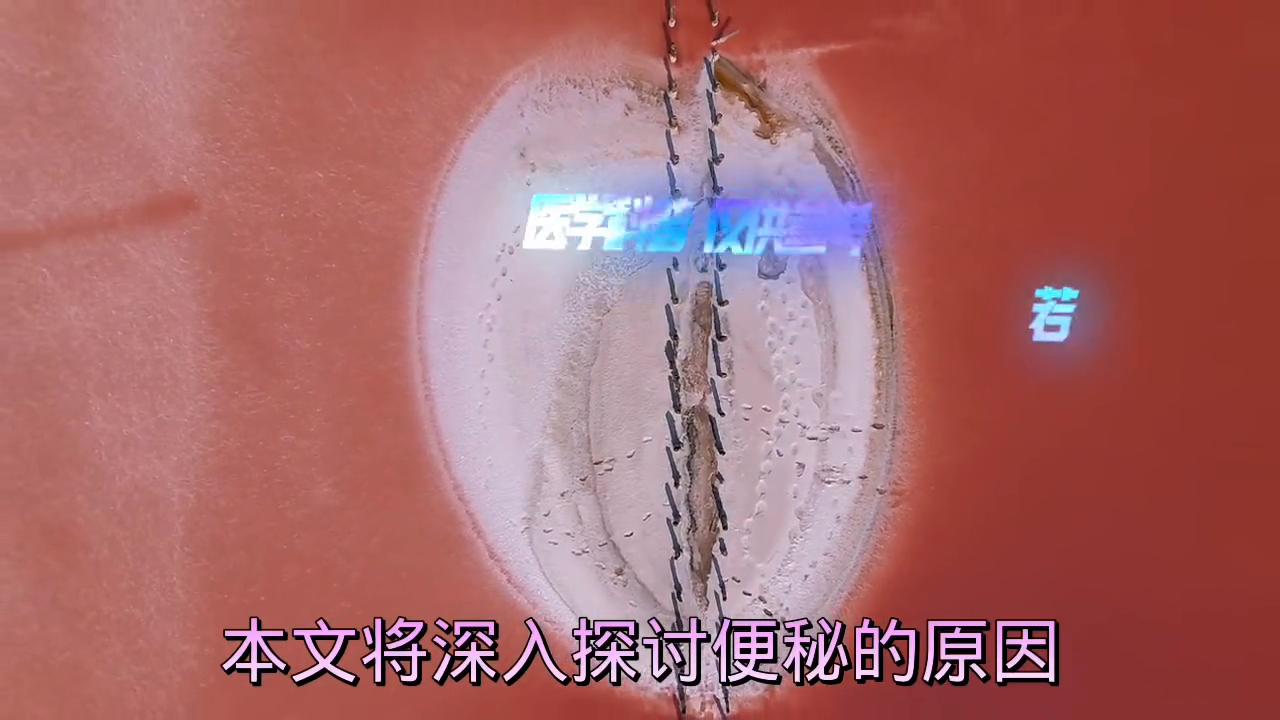 金黑鹰教授：便秘的预防和治疗方法