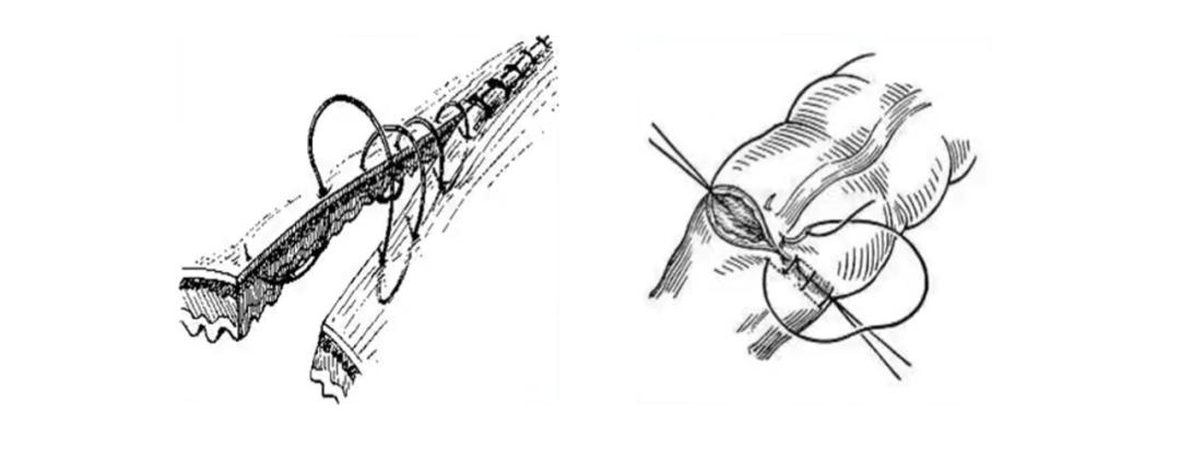 外科各种缝合方法的适用情况,外科操作缝合