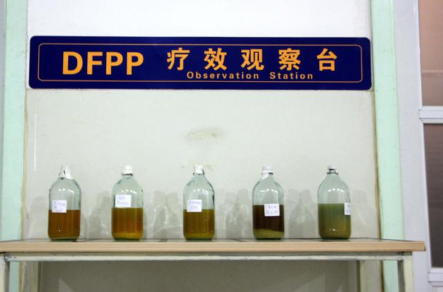 肾功能衰竭全身换血,急性肾衰可以换血么