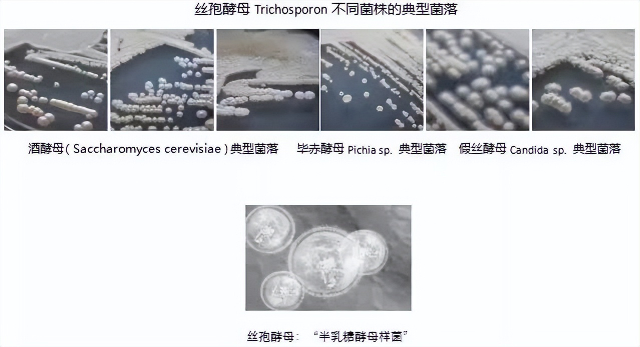 你真的会用爽肤水这些误区要避开,爽肤水到底是鸡肋还是护肤必备