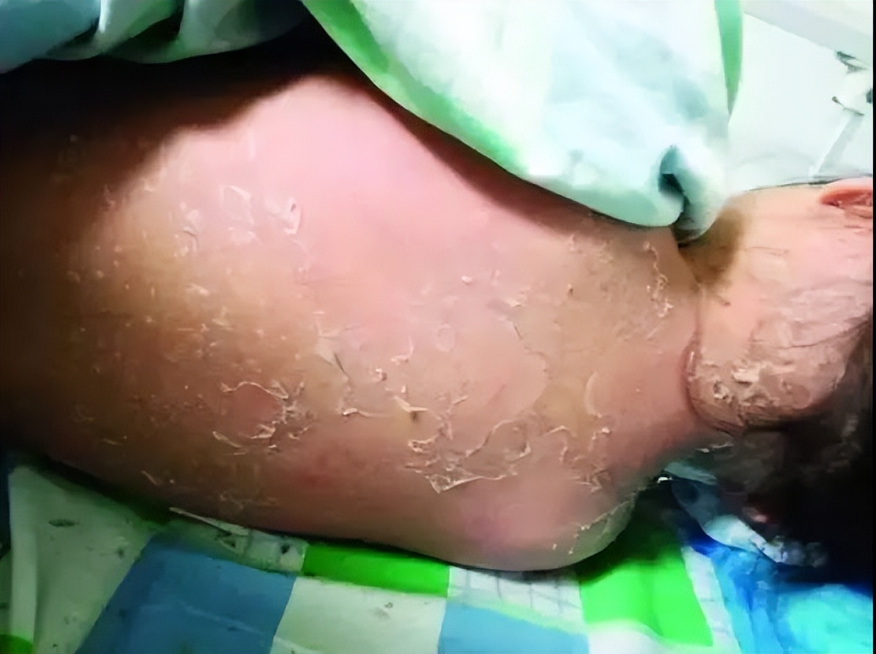 尿、粪便、细菌、寄生虫,不去一次泳池,你永远不知道有多脏