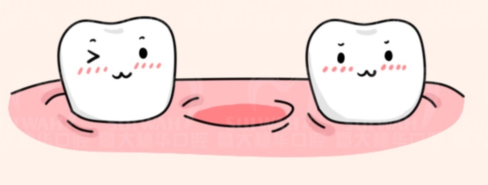 拔了下颚智齿后有个洞堆积残渣,智齿上面有个洞是补还是拔了好
