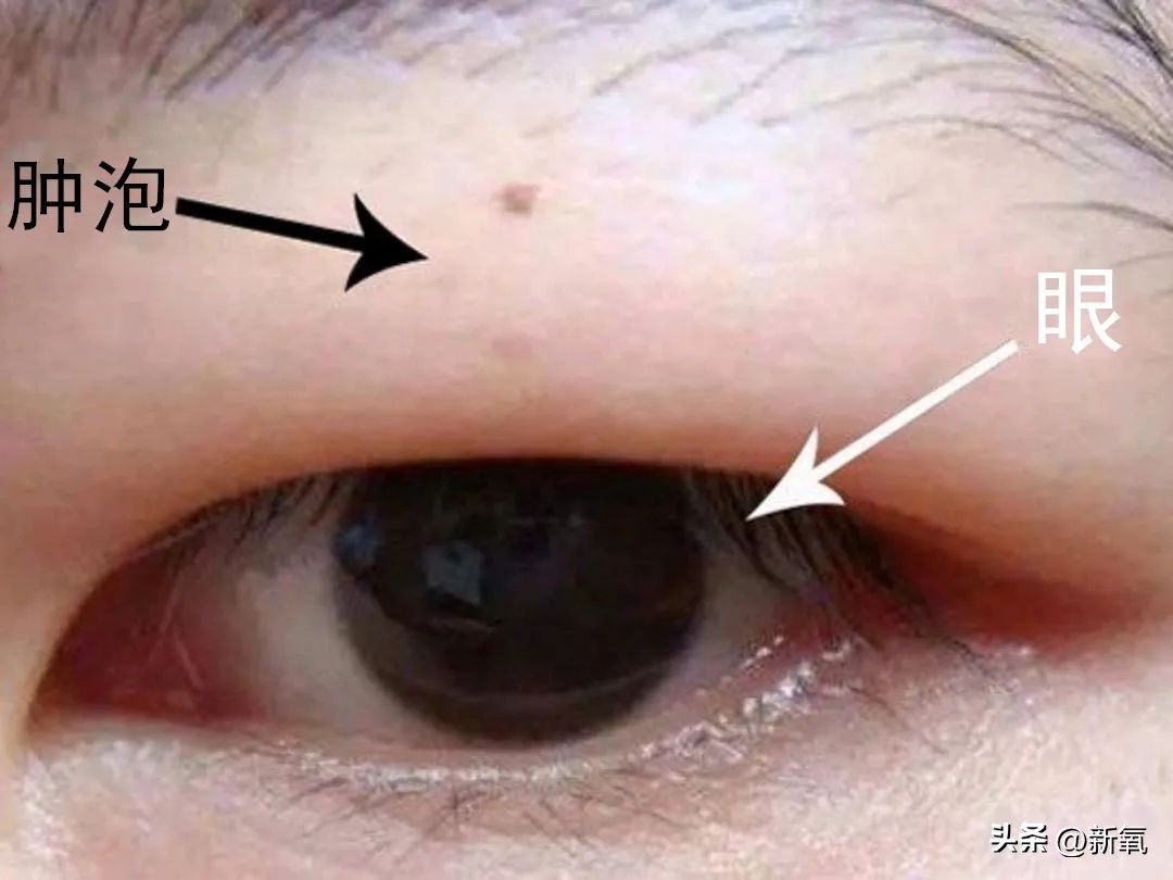 眼睛怎么才能变成星星眼,怎么让眼睛变星星眼