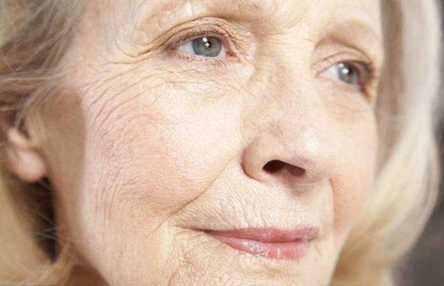 抗皱纹的天然食物,可以防止皮肤皱纹生成的食物