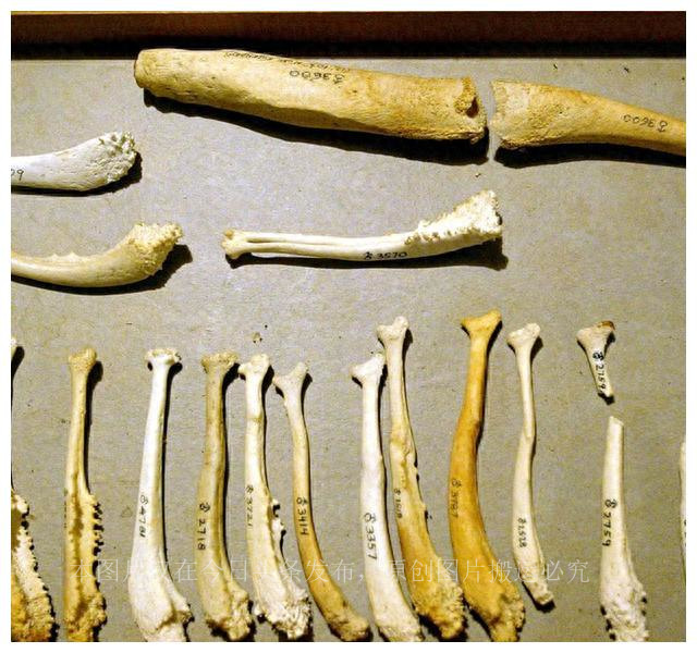 人类祖先的“丁丁”有骨头，现代人类怎么没有“丁丁骨”了呢？