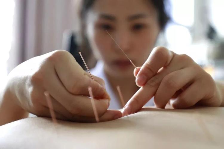 治腰椎间盘突出埋线得几天见效,腰椎间盘突出电针灸治疗的原理