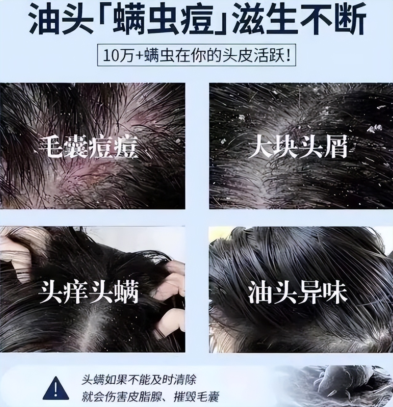 超市里的洗发水推荐真实测评,推荐超市里好用的几款洗发水