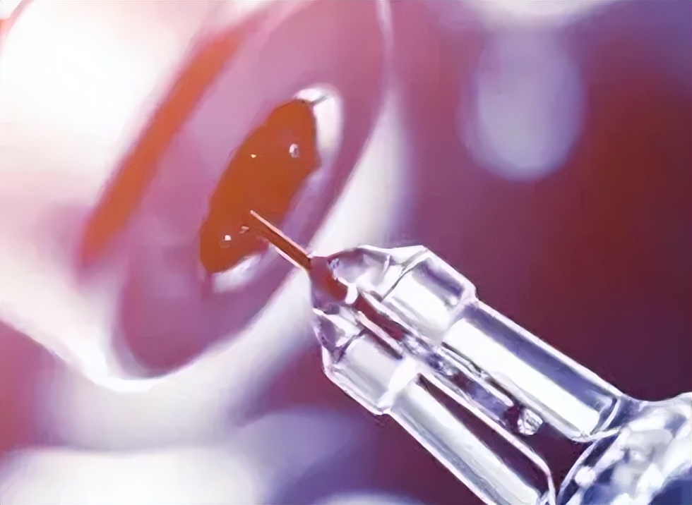 先天性肛门闭锁最新治疗方法,先天性肛门闭锁怎么治疗