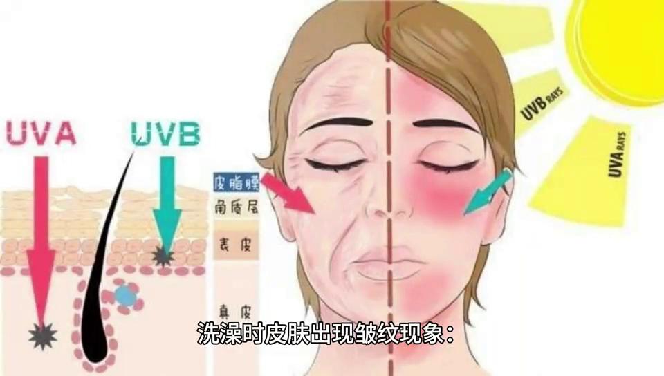 洗澡手起皱纹是怎么回事,洗澡时手指起皱纹怎么办