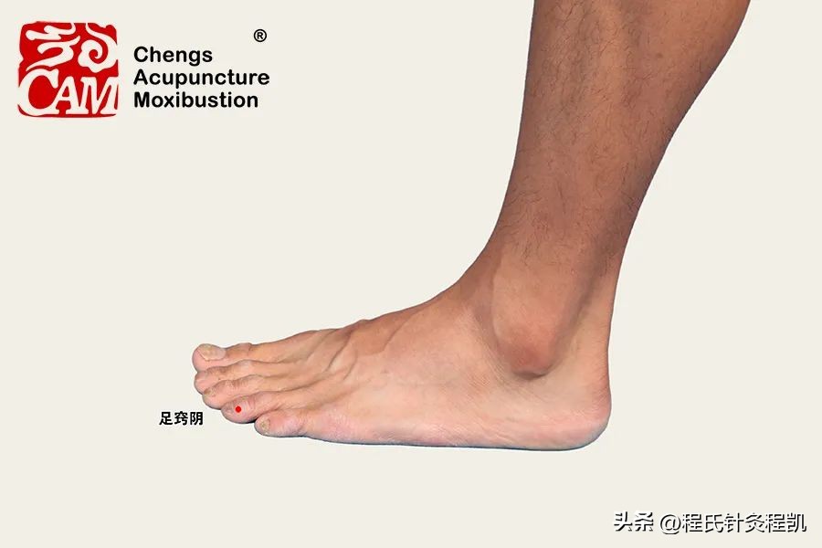 程凯养生说·虎年中医课：皮肤总有湿疹，是不是内部脏器有问题