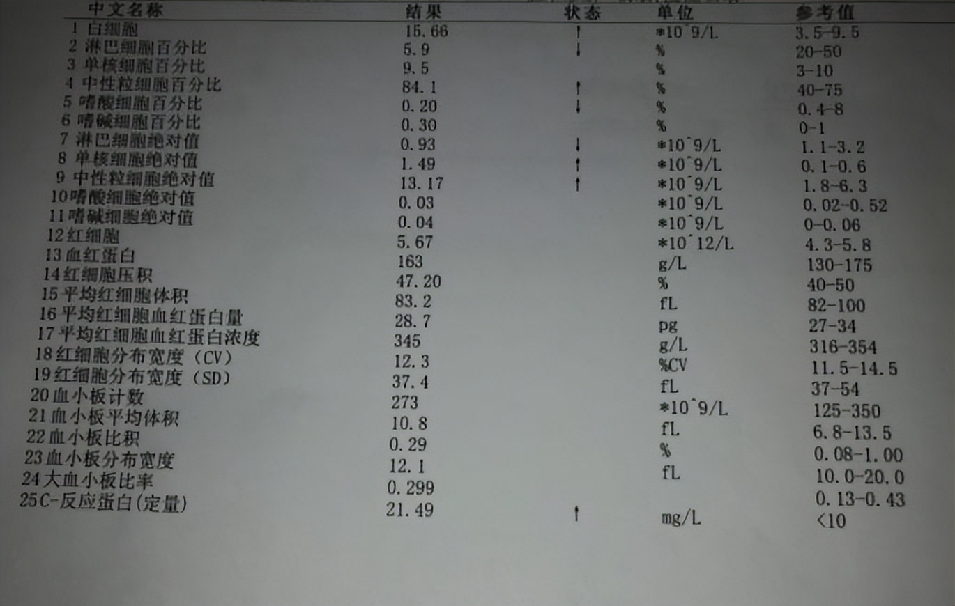 血常规哪些项目异常要警惕,血常规这几项异常一定要引起重视