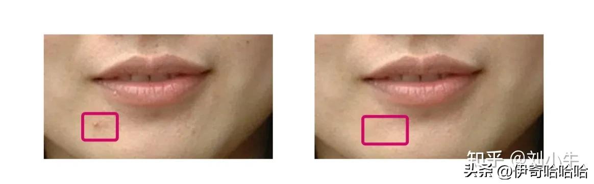 photoshop使用仿制图章工具,如何使用仿制图章和污点修复工具