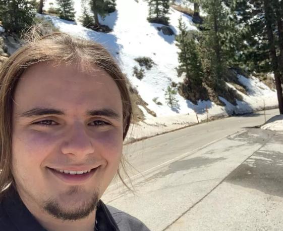 迈克尔杰克逊去世得了什么疾病,迈克杰克逊儿子遗传白化病