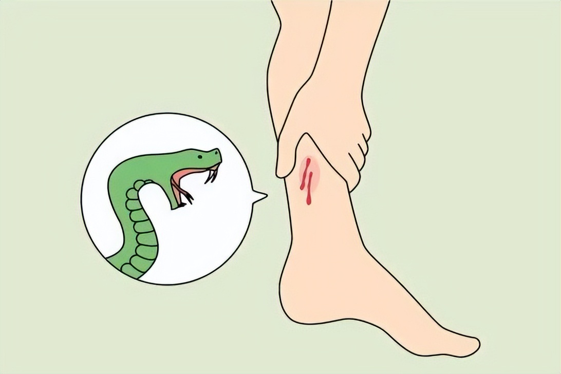 当心蛇出没,夏天蛇多如何防蛇避蛇