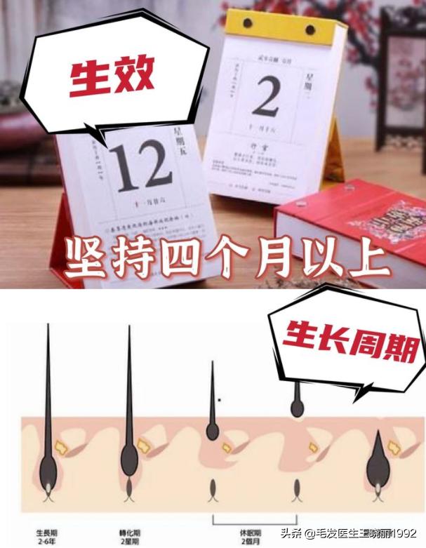 米诺地尔用了一年了可以停吗 (米诺地尔搽剂要用多久可以停)