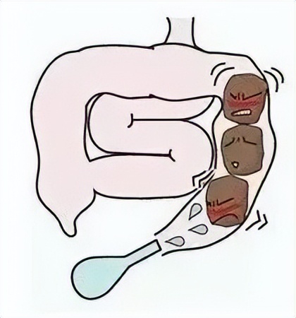 10个月宝宝排便困难哭,宝宝拉屎哭拉不出来怎么办