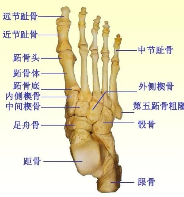 扁平足发病机制,扁平足诊断标准示意图
