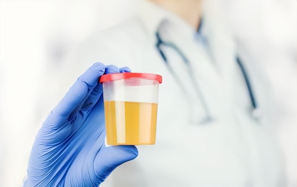 70岁老人尿潜血试验结果阳性,尿血红蛋白潜血阳性是什么意思