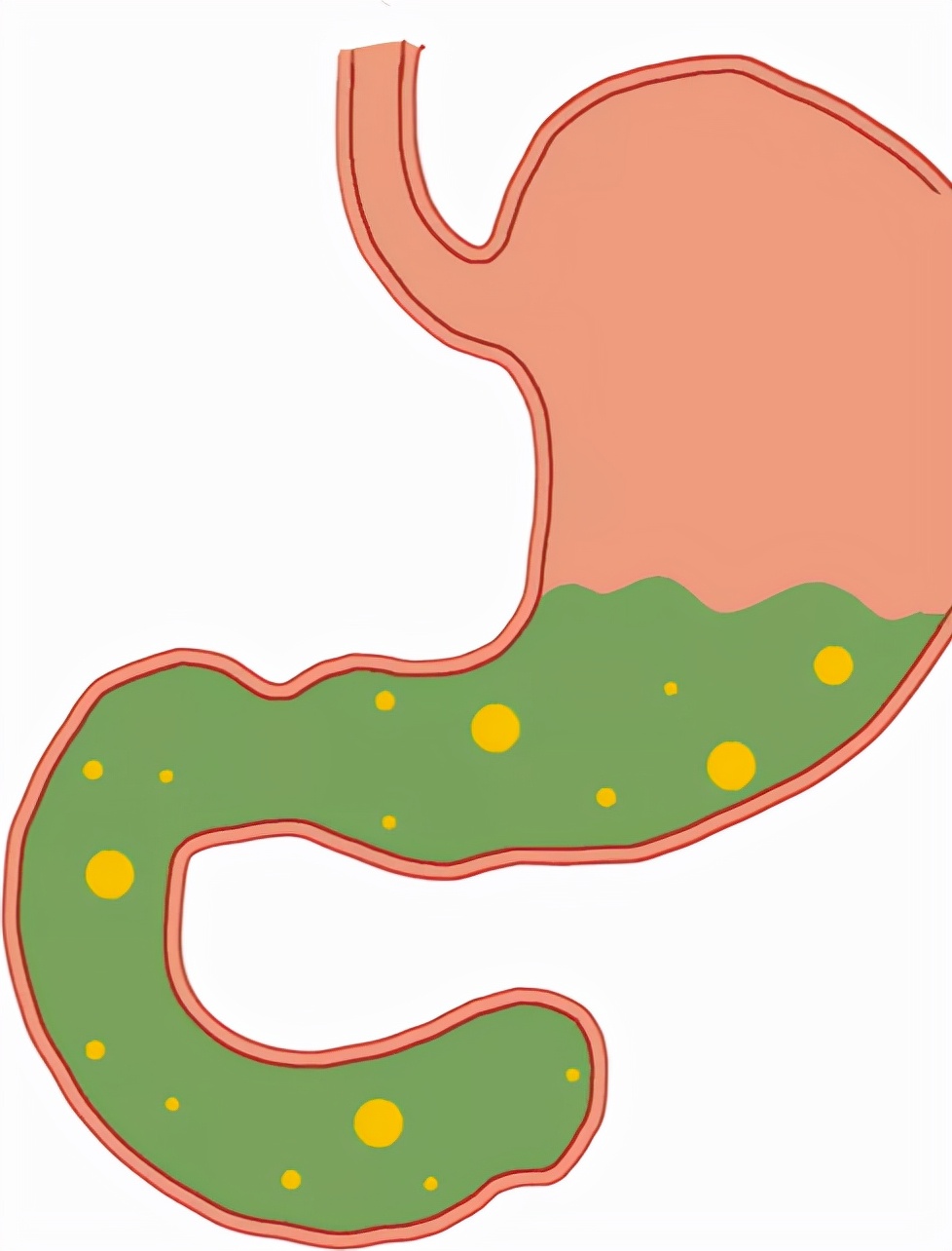 口苦口涩是肝不好还是胃不好,口苦口臭肝区胀怎么回事