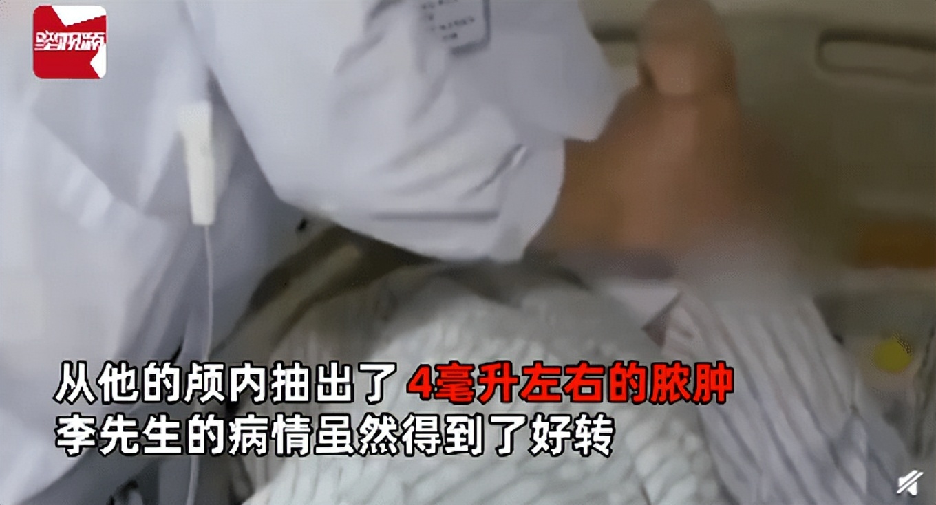 长痘痘戴口罩会加重痘痘吗,长痘跟戴口罩有关系吗